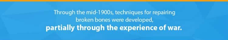 Fact: mid-1900s techniques for repairing broken bones developed from the war