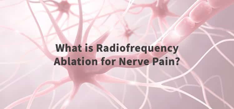 radiofrequency ablation for nerve pain cover photo - image of nerve tissue