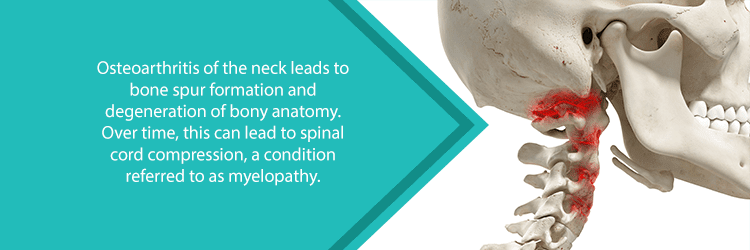 cervical spinal stenosis caused by osteoarthritis