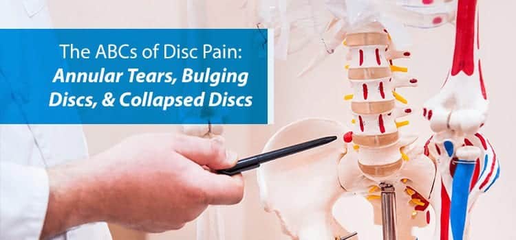 doctor pointing to bulging disc