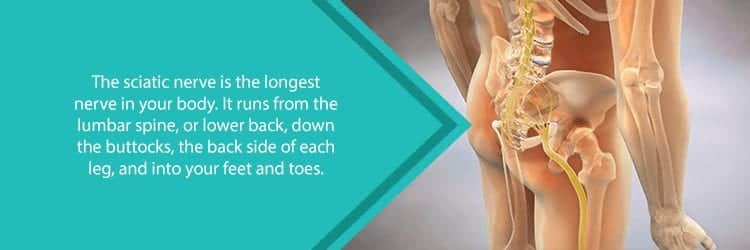 What You Need to Know About Sciatica - NJ's Top Orthopedic Spine