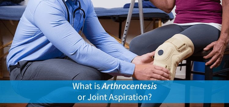 woman who needs joint aspiration or arthrocentesis