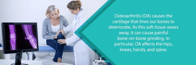 x-ray of woman's knee with osteoarthritis