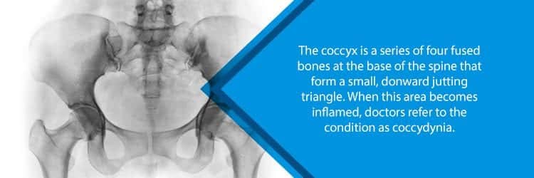 x-ray showing coccyx, sacrum, and hips