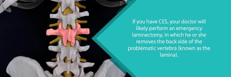 affected vertebra for laminectomy