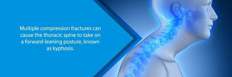 Vertebral Compression Fracture – NJ Spine Center