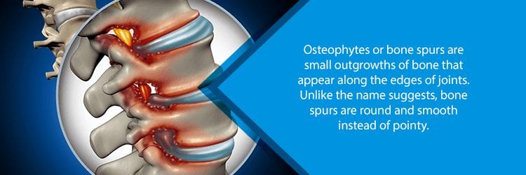 spinal bone spurs