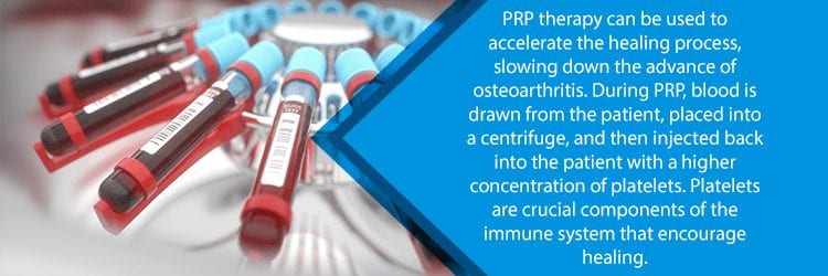 prp therapy for hip osteoarthritis