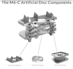 m6-c articificial disc replacement