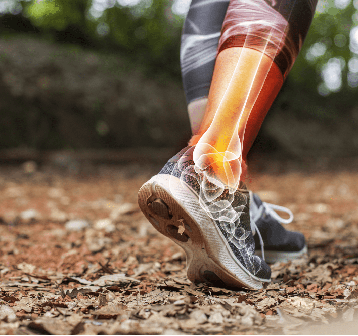 Leg pain