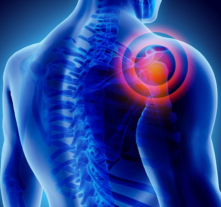 shoulder pain