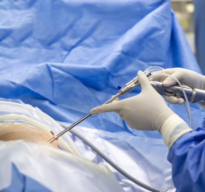 Disc surgery in sciatica pain