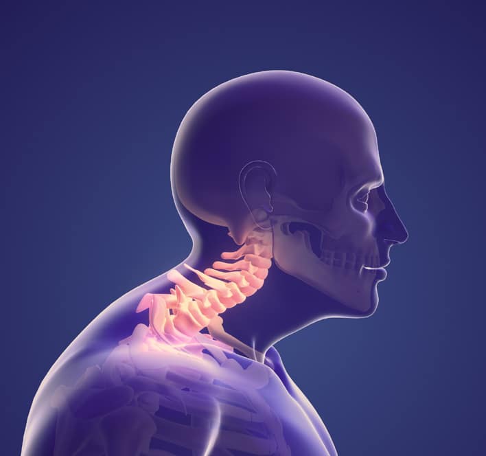 Do I Have the Symptoms of Cervical Bone Spurs NJ Spine Orthopedic