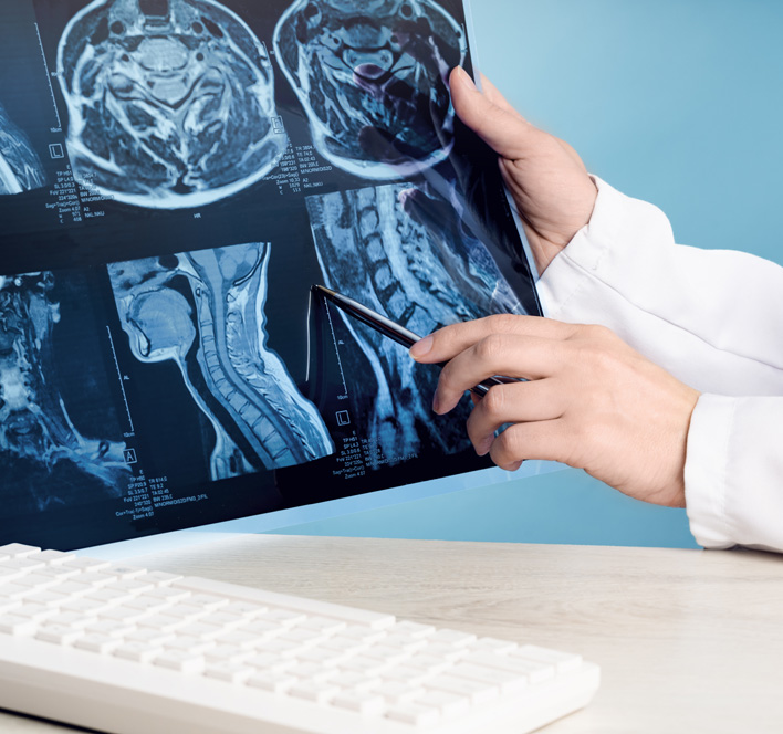 doctors holding x-ray or MRI medical imaging