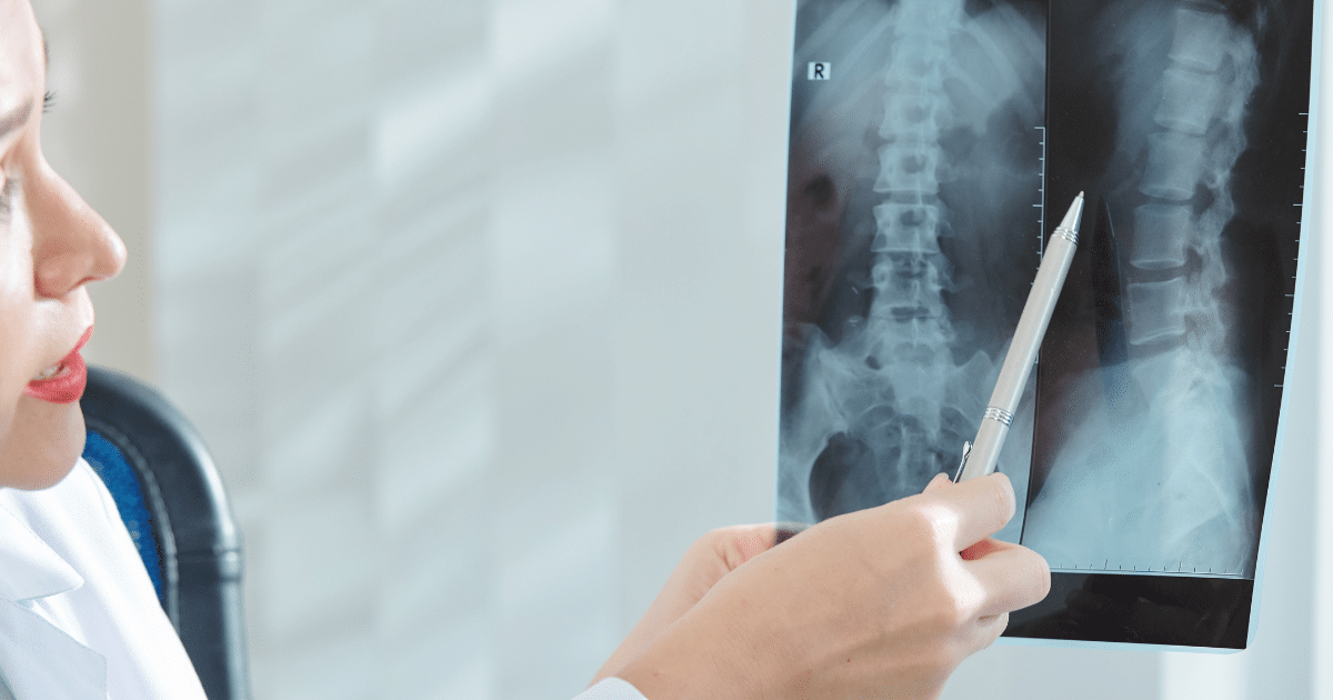 Spine specialist reviewing imaging with a patient in a clinical office setting, calm and professional.