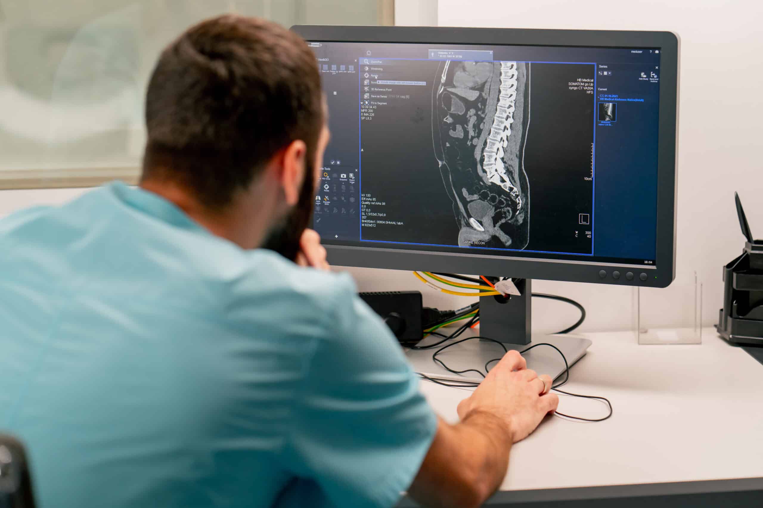 Doctor reviewing spinal imaging while discussing spine surgery recovery timeline
